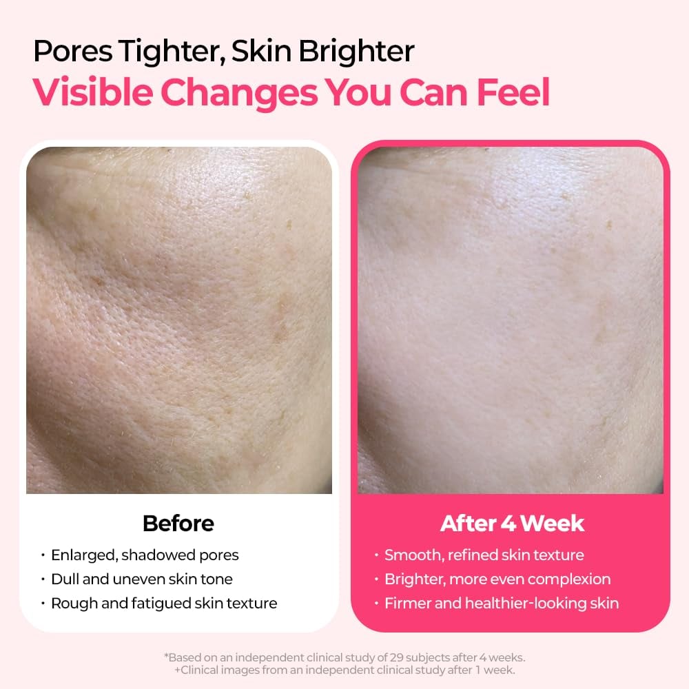 š„Pore & Spot Care Duo