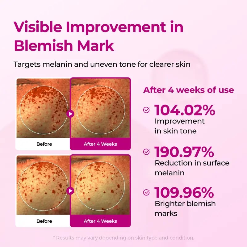 š„Pore & Spot Care Duo