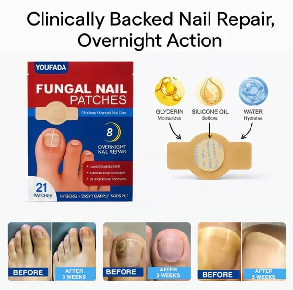 Fungal Nail Renewal Patches