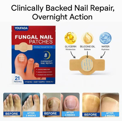 Fungal Nail Renewal Patches