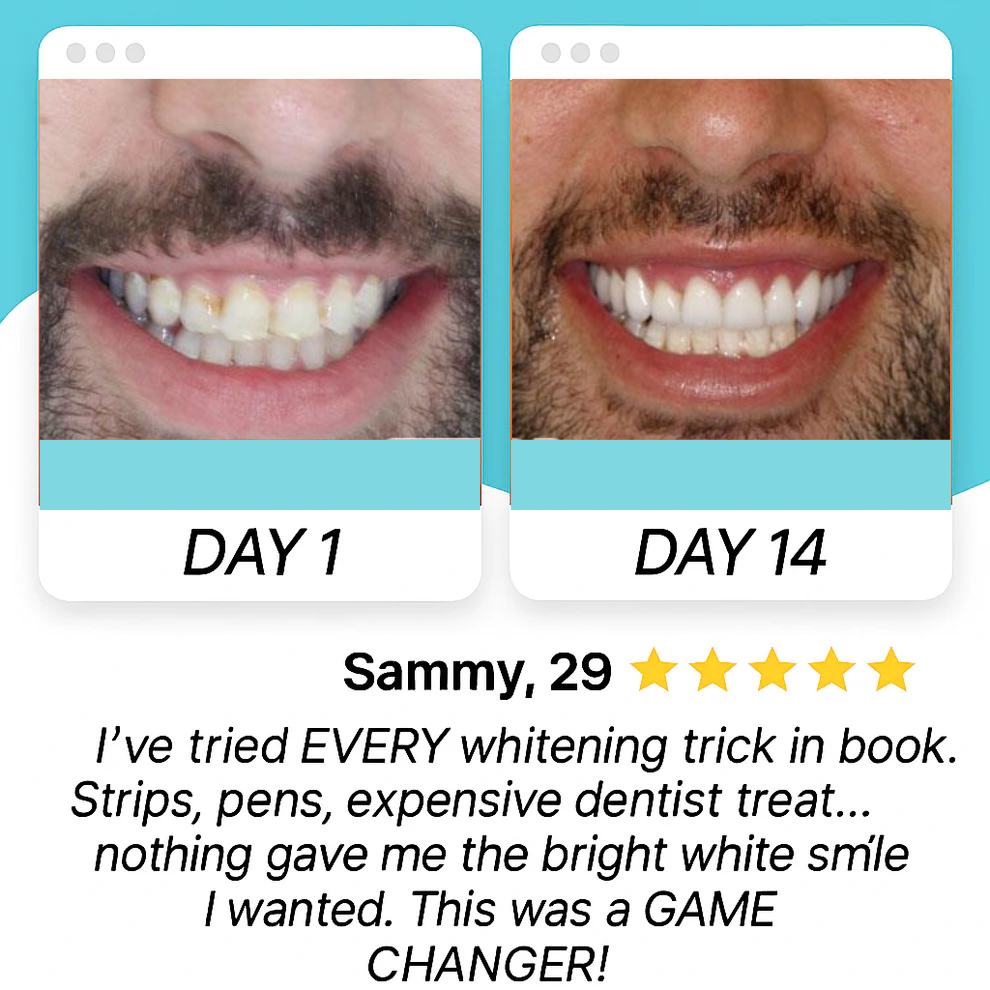 360° Advanced Toothbrush