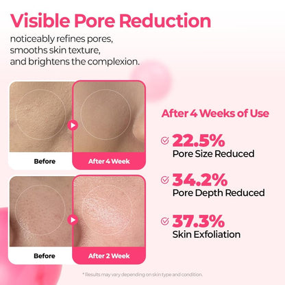 🔥Pore & Spot Care Duo