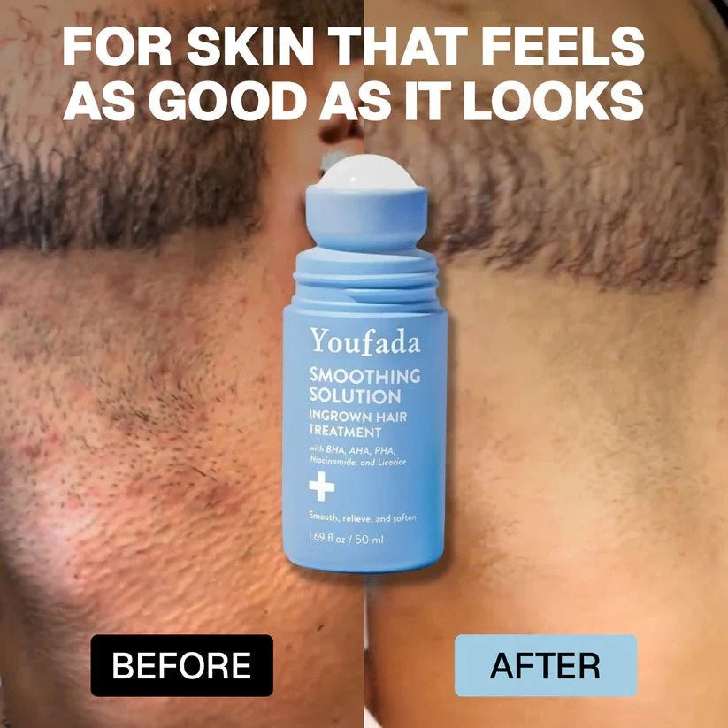 Smoothing Solution For Ingrown Hairs