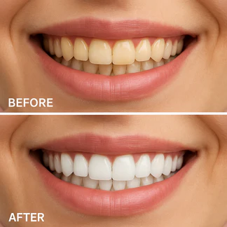 360° Advanced Toothbrush